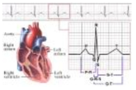 심장과 ECG