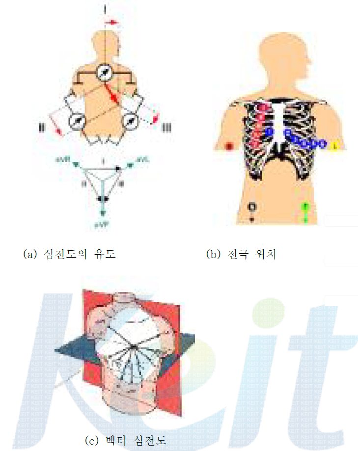 심전도 측정