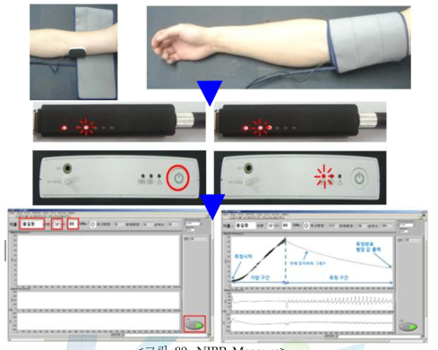 NIBP Measure