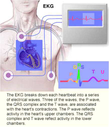 심전도(ECG) 개요