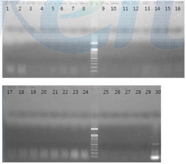 위의 Total RNA 시료를 CV5 KIT Test.