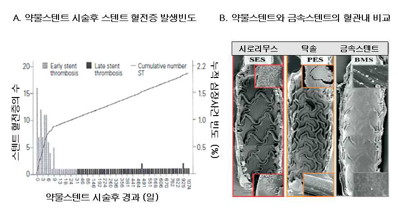 스텐트혈전증 발생빈도와 약물스텐트의 시술후 경과관찰시 조직학적 소견