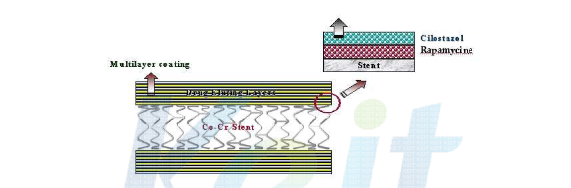 약물코팅 스텐트 모식도