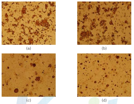 Anti Cytoskeratin Stain을 통한 Primary Tumor Cell 유무 확인