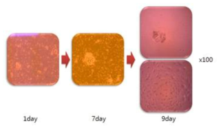 Case #1에서 Primary Tumor Cell 성장 관찰