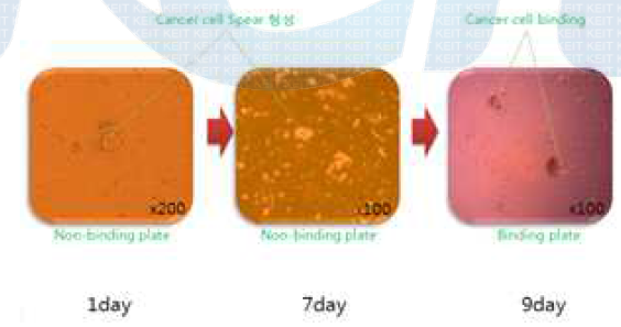 Case #2에서 Primary Tumor Cell 성장 관찰