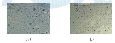 Case #11에서 배양된 Primary Tumor Cell 관찰