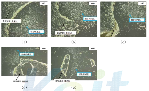 Dispase를 이용한 2종세포의 분리