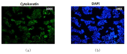 종양세포마커인 Cytokeratin 형광염색