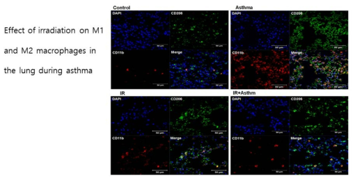 천식동물모델에 저선량율 방사선 조사에 의한 M1/M2 macrophage 의 변화