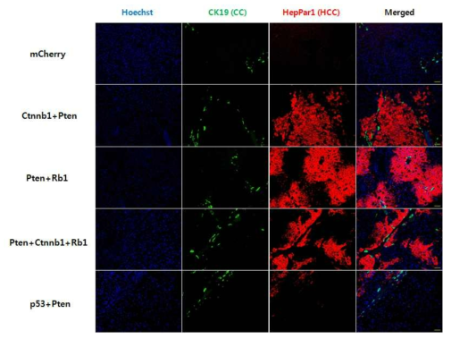 간세포암 (Hepatocellular carcinoma) 와 담관암 (Cholangiocarcinoma) 생성