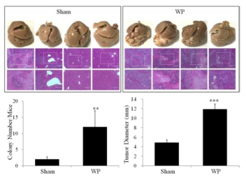 혈소판에 의한 간암세포의 tumorigenic ability 증가