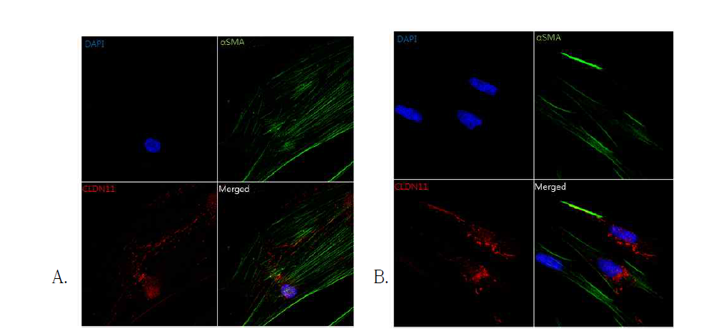 siRNA-Cldn11 처리에 따른 CLDN11 발현 위치 변화.