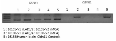 RT-PCR을 이용한 coronary a. (LAD) 및 middle cerebral a. (MCA)에서 Cldn11 mRNA 발현