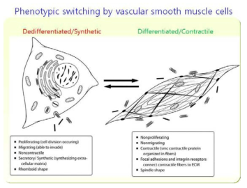 근육세포 표현성 변화