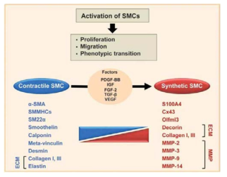 동맥경화증에 따른 혈관근육세포 표현형 변화 조절 인자