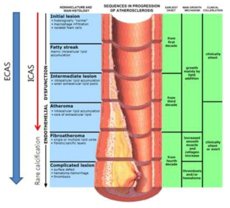 The progression of atherosclerosis