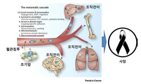 Metastasis 의 단계