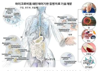 한국인 마이크로비옴 패턴분석 및 패턴제어기반 치료질병군