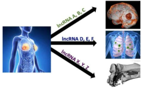 유방암 기관 특이적 전이에 관여하는 long non-coding RNA (lncRNA) 발굴 및 기능 연구 개요