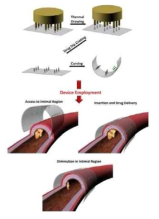 혈관 질환 치료용 마이크로니들 장치 제작 및 적용 개념도