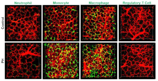 폐동맥 고혈압 마우스의 immunophenotype