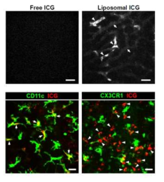 마우스 생체 내 간 조직에서의 일반 ICG와 리포좀 ICG의 면역세포에 의한 대사 결과 영상