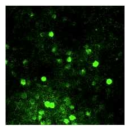 mouse brain의 in vivo Calcium imaging