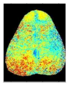 OxyHb으로 CBV 측정한 brain의 in vivo imaging