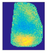 VSD imaging. 후두엽 활성증가를 보임