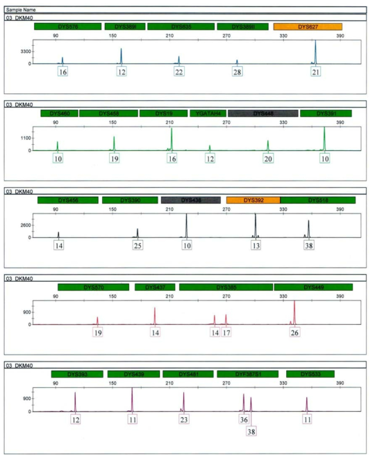 Genotyping result of Korean sample amplified with the Yfiler Plus PCR Amplification Kit and analyzed on a 3500xL Genetic Analyzer.
