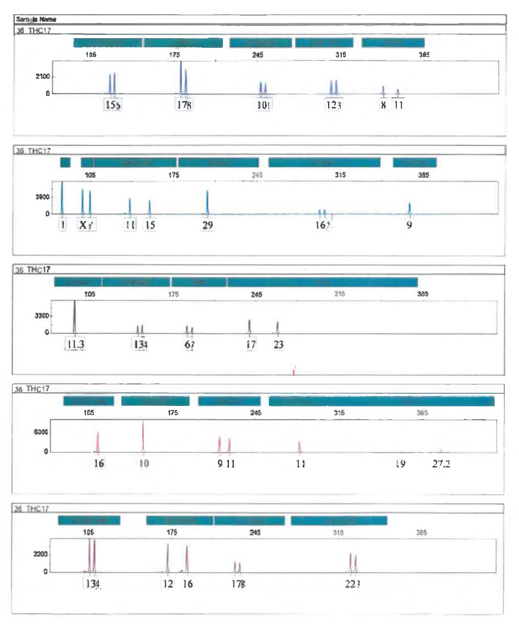 Electropherograms of A-STRs genotypes analysed by a 3500xL Genetic Analyzer using the GlobalFiler PCR Amplification Kit.