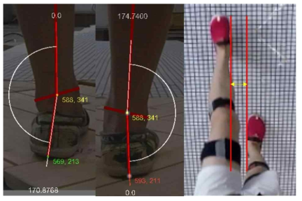 영상분석을 위한 각도 측정 및 간격 측정 예시