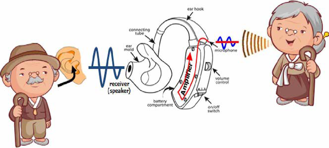 보청기의 간단한 원리 및 구성