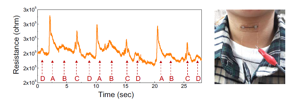 인체 목에 부착된 다층센서소자의 사진 및 알파벳 발음시 다층센서소자의 저항특성