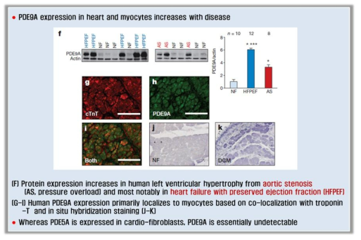 Expression in PDE9A in patient with cardiovascular disease