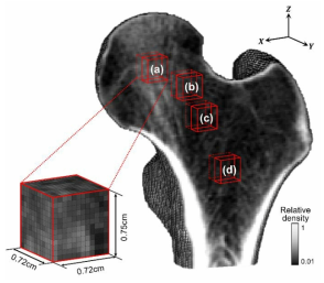 Four volumes of interest (VOIs) in the proximal femur: (a) femoral head, (b) femoral neck, (c) Ward’s triangle, and (d) intertrochanter