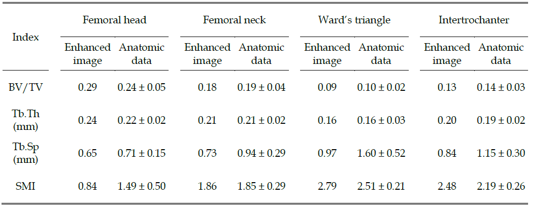 Comparison of the morphometric indices obtained from the reconstructed trabecular bone and the literature: bone volume fraction (BV/TV), trabecular thickness (Tb.Th), trabecular spacing (Tb.Sp), and structure model index (SMI).