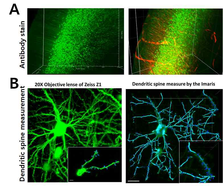 brain slice 조직(약 500 um)에서 1차 용액을 통한 antibody stainning후 새로 개발한 용액으로 투명화 진행시 염색이 잘 되었으며 light sheet microscope의 20x Lense를 이용하여 dendritic spine까지 확인가능할 수 있는 방법을 개발함