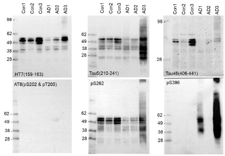 알츠하이머병 및 대조군 환자 유래 뇌조직에 대한 타우단백질 분석