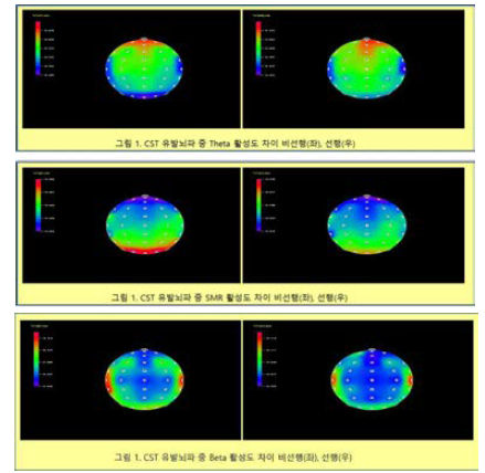 활성뇌파에 대한 선행학습자(우) 와 비선행학습자(좌) 의 후두엽에서 나타나 는 뇌파 활성차이를 theta(위), SMR(중 간), beta(아래)로 나 누어서 보여준 결과