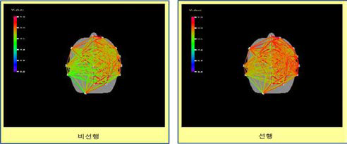 선행학습 자와 자와 비선행학습 자 간의 뇌 연결성 차 이