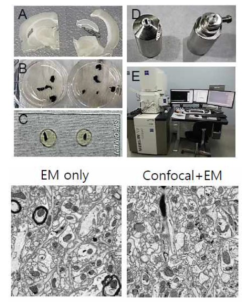 광학기술 연계를 위한 연속블록면 전자현미경 시료제작 최적화.