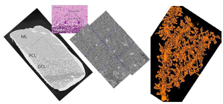 2 X 3 montage 기능으로 획득한 소뇌피질 분자층 이미지 (각 영역 당 1000장의 50 nm 두께 이미지 획득, 100 X 150 x 50 um3).