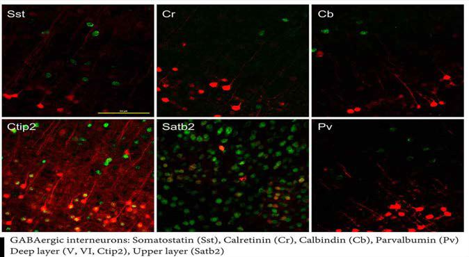 시각피질의 신경 활성에 의해 표지되는 신경세포 확인.