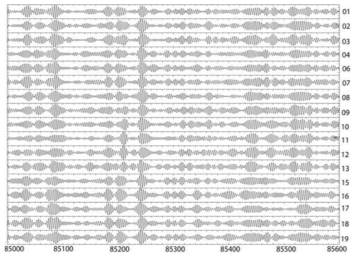 Bandpass filterd microseismic seismograms.