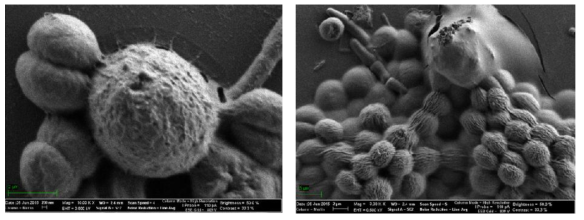 채취된 미세조류(녹조류)의 전자현미경 사진