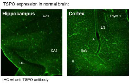 일반 생쥐의 해마와 대뇌 조직에서 TSPO 분포양상
