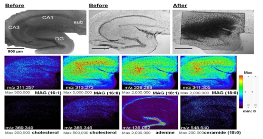 쥐 해마조직의 광학이미징과 대기압 질량분석 이미징.