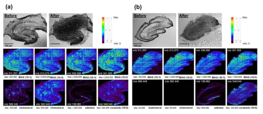 대기압 질량분석 이미징 방법을 이용한 쥐 해마조직의 약물처리 효과.